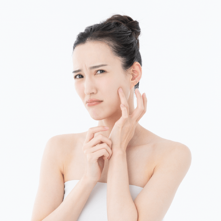 肌トラブルに悩む女性